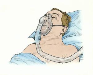 Illustration of a person using a CPAP machine