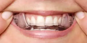 Sleep apnea treatment device in a mouth